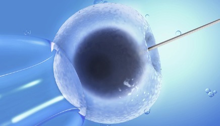 体外受精 IVF-ET